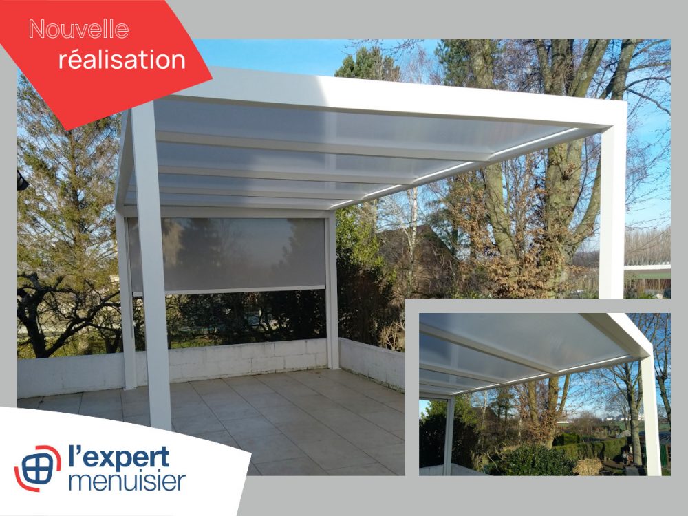 Installation pergola aluminium ville de lens